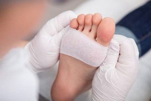 انجام پانسمان های جراحی بدسور دیابتی و در منزل در مشهد بلوار پیروزی